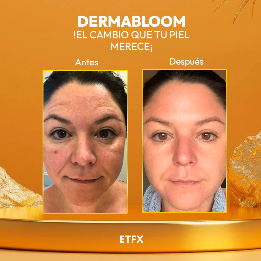 DERMABLOOM™ – Juventud, Firmeza y Luminosidad en Cada Aplicación